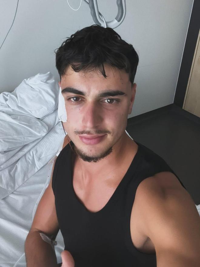 帕夫洛維奇術后照，恢復良好，即將歸來